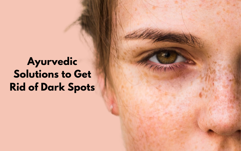 Best Ayurvedic Treatments for Dark Spots on Face Blue Nectar