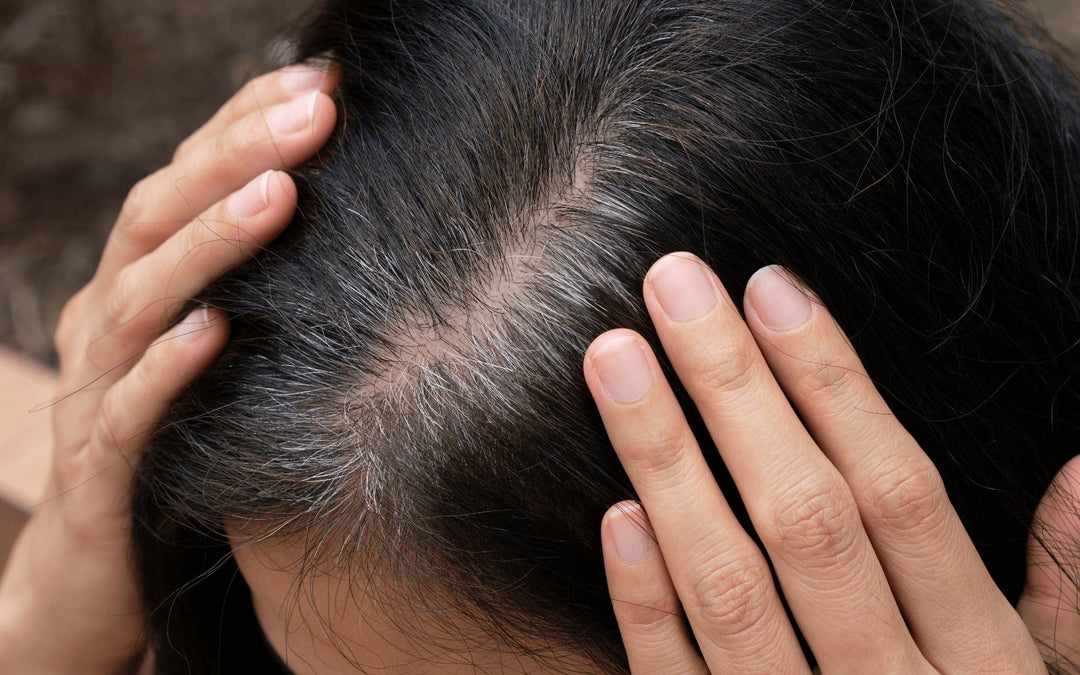 10 Tips to prevent premature greying of hair with ayurvedic hair oil - Blue Nectar Ayurved