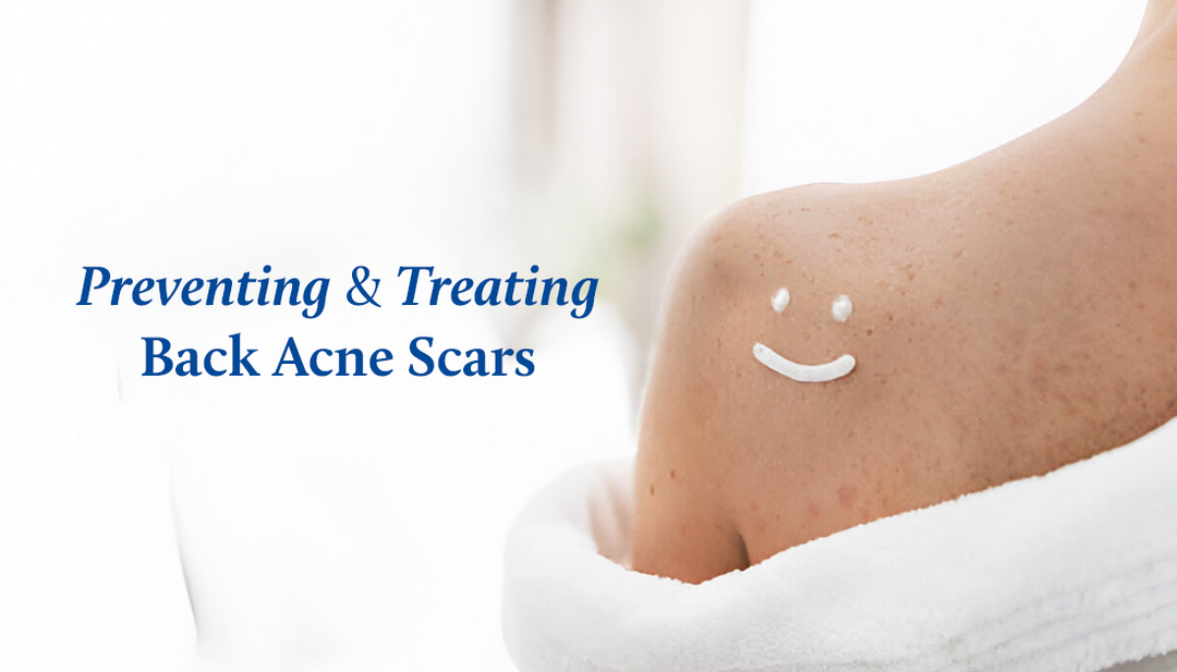 Back Acne Scars - Prevention, Treatment and Recovery