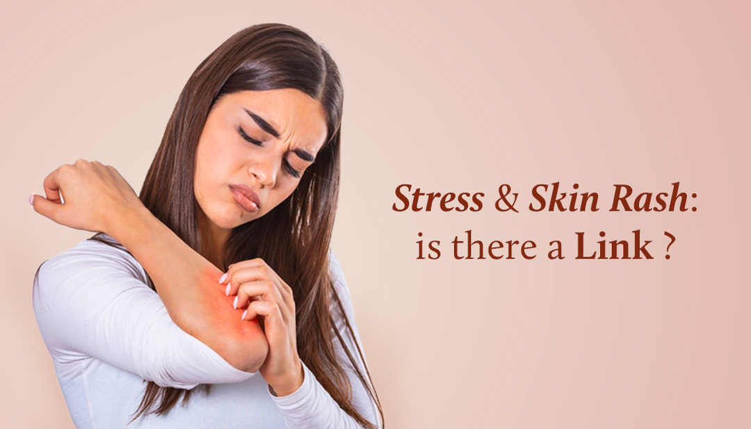 The lady is gently rubbing her elbow, trying to soothe the irritation caused by rashes.