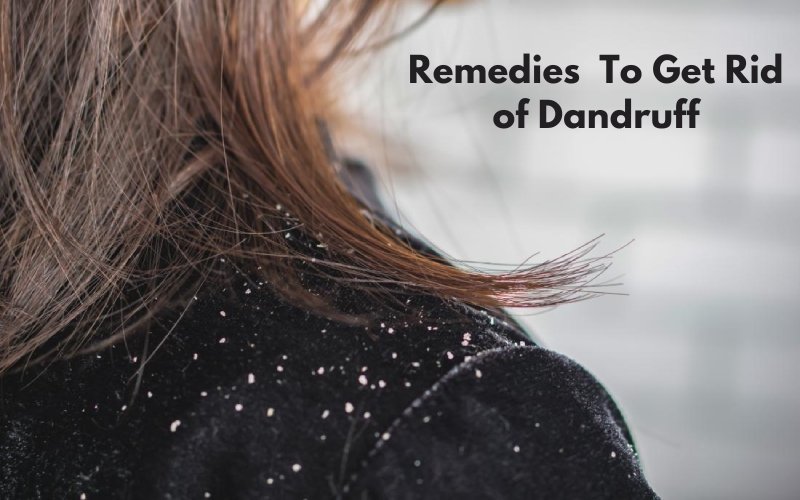 All About Dandruff: Types, Preventions, and Remedies - Blue Nectar Ayurved