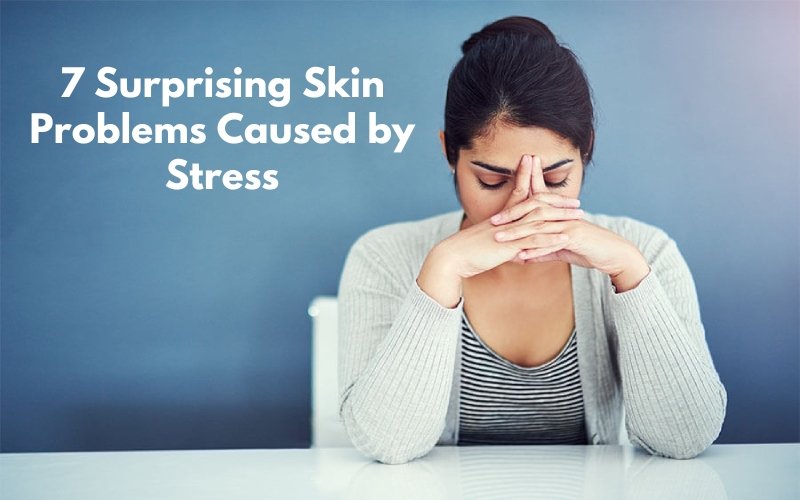 How to take care of Skin problems that cause by stress? - Blue Nectar Ayurved