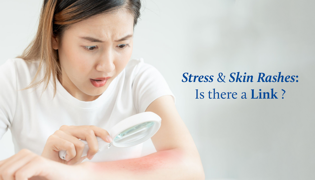 Can Stress cause Skin Rash? Other effects of Stress on Skin and How to Prevent?