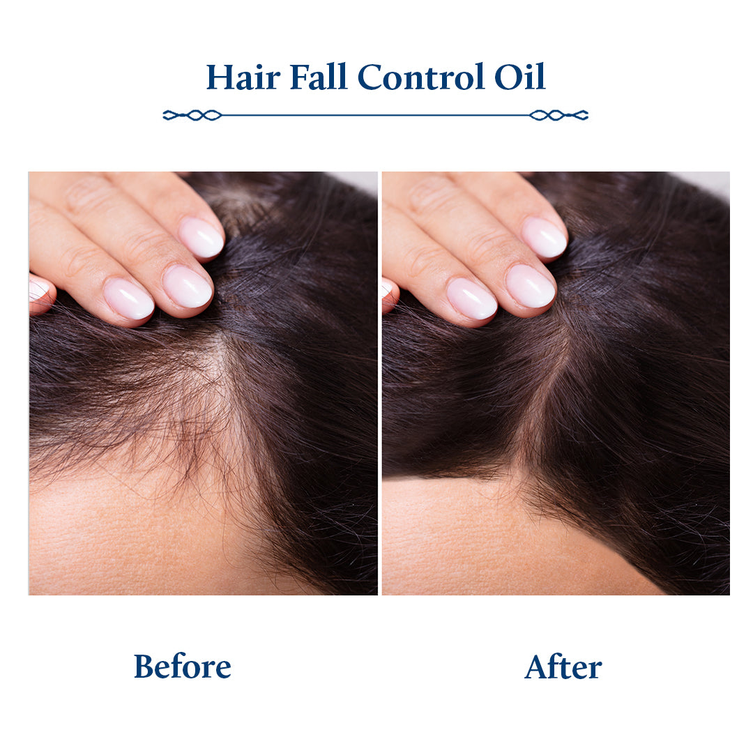 Hair fall control