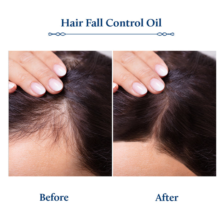 Hair fall control